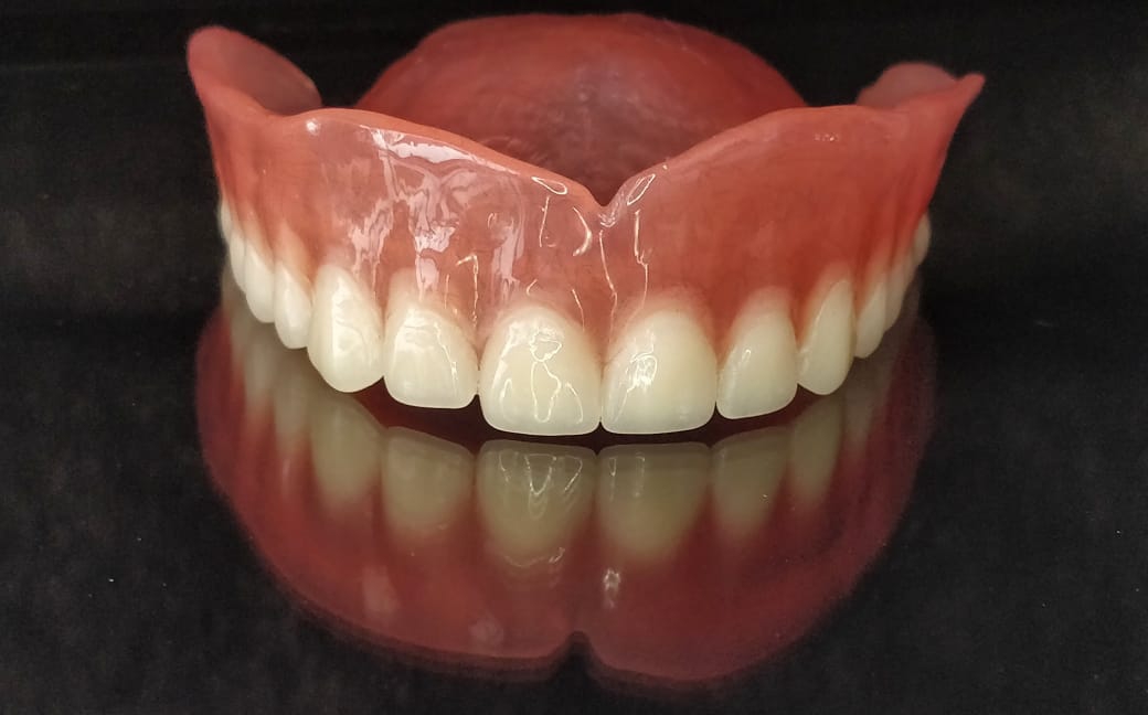 CUSTOMIZED-DENTURES