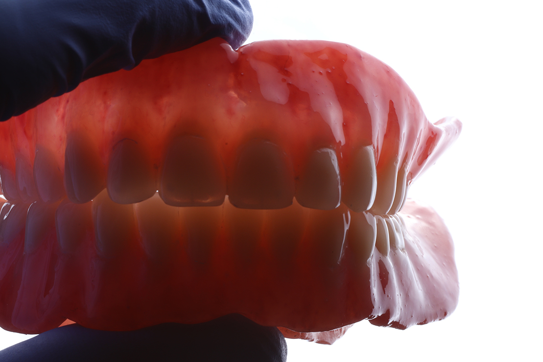 CUSTOMIZED-DENTURES