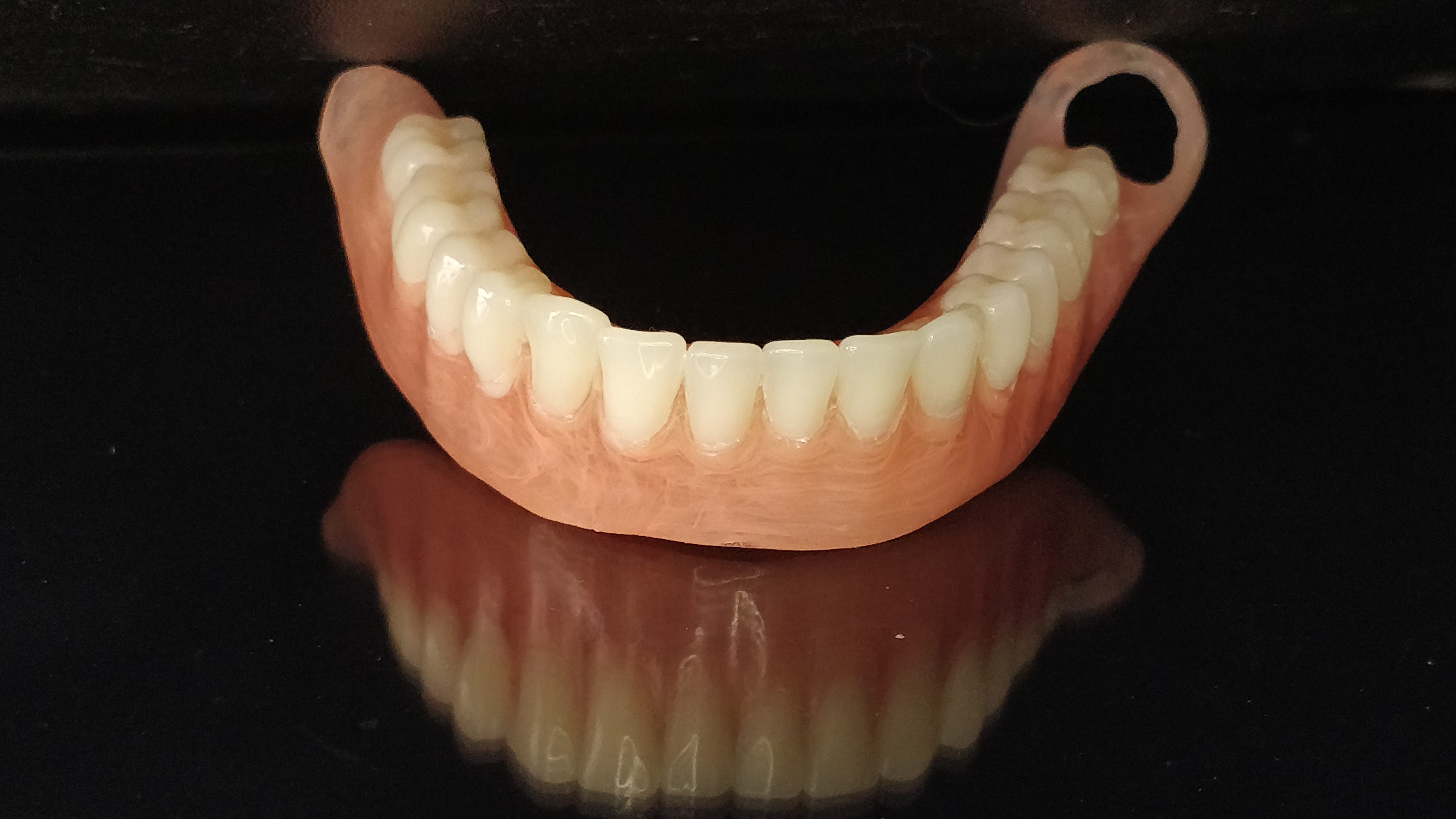 CUSTOMIZED-DENTURES